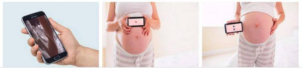 برنامج ايكو حمل\ تصوير الجنين اثناء الحمل prank أفضل تطبيقات الحمل والأمومة